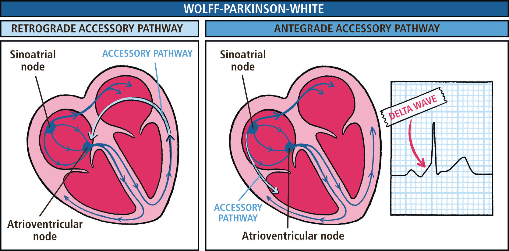 Critical Care and Hospitalist Medicine Made Ridiculously Simple