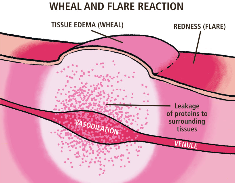 Allergy and Asthma Made Ridiculously Simple