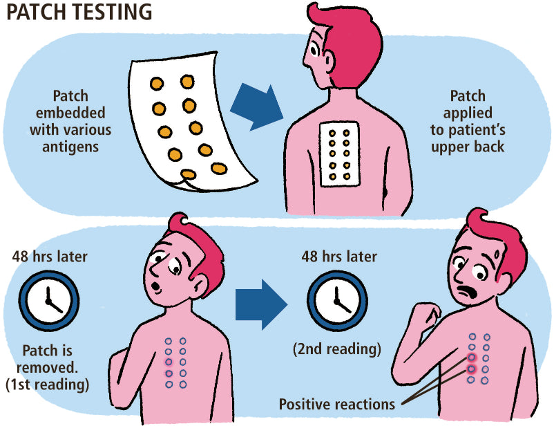 Allergy and Asthma Made Ridiculously Simple
