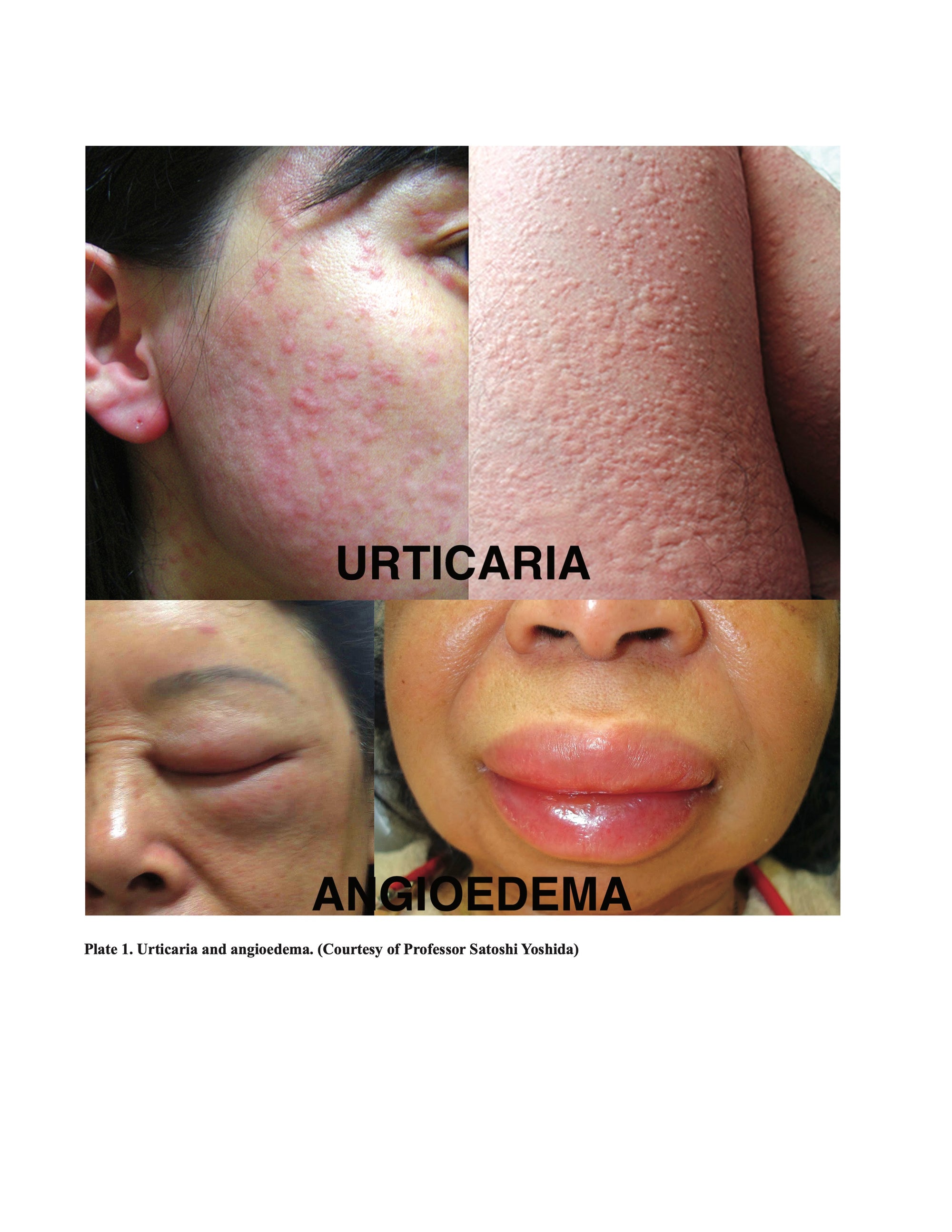 Allergy and Asthma Made Ridiculously Simple