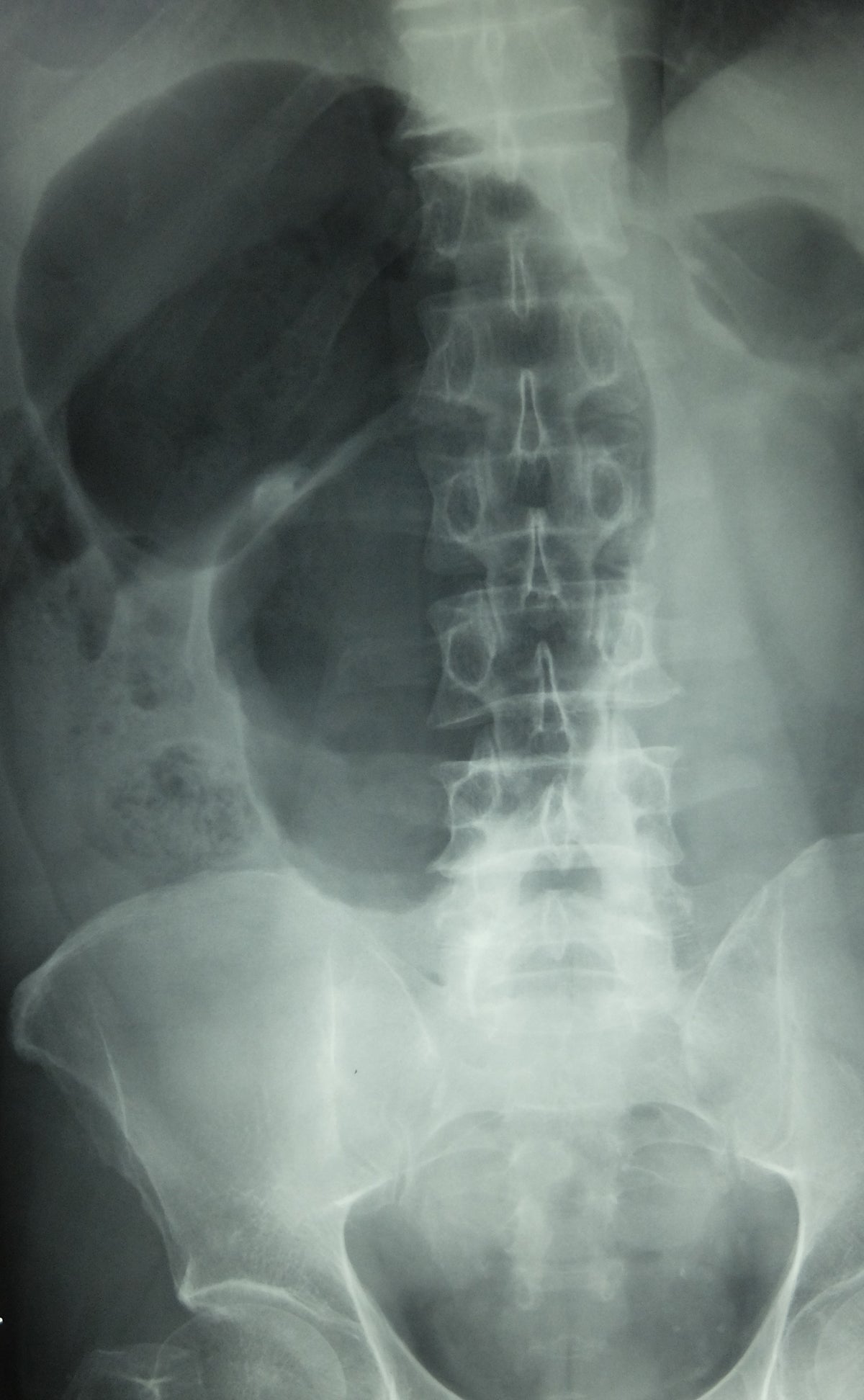 Gastroenterology Made Ridiculously Simple