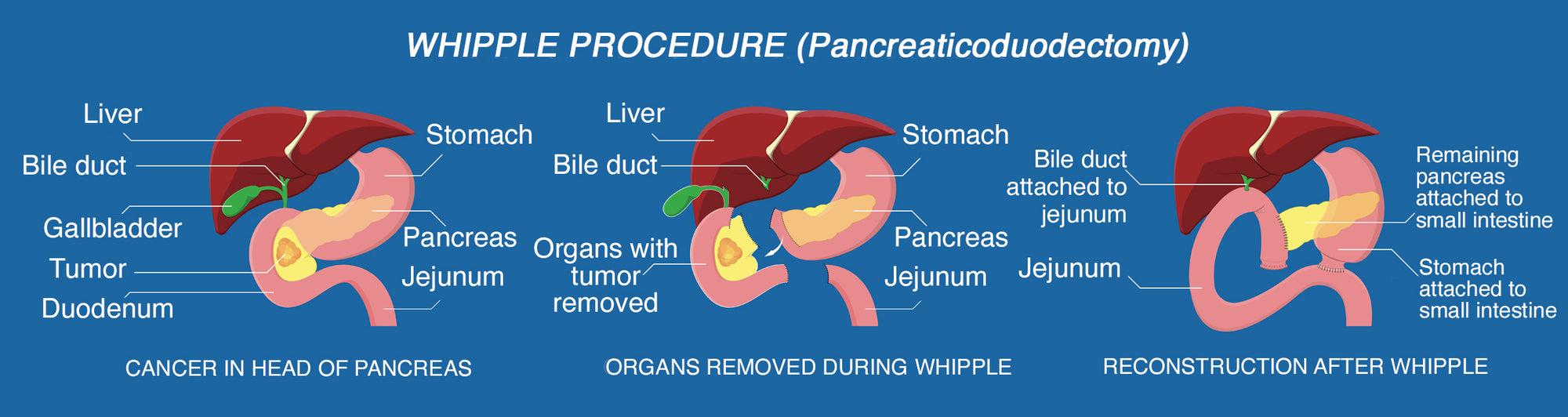 Gastroenterology Made Ridiculously Simple