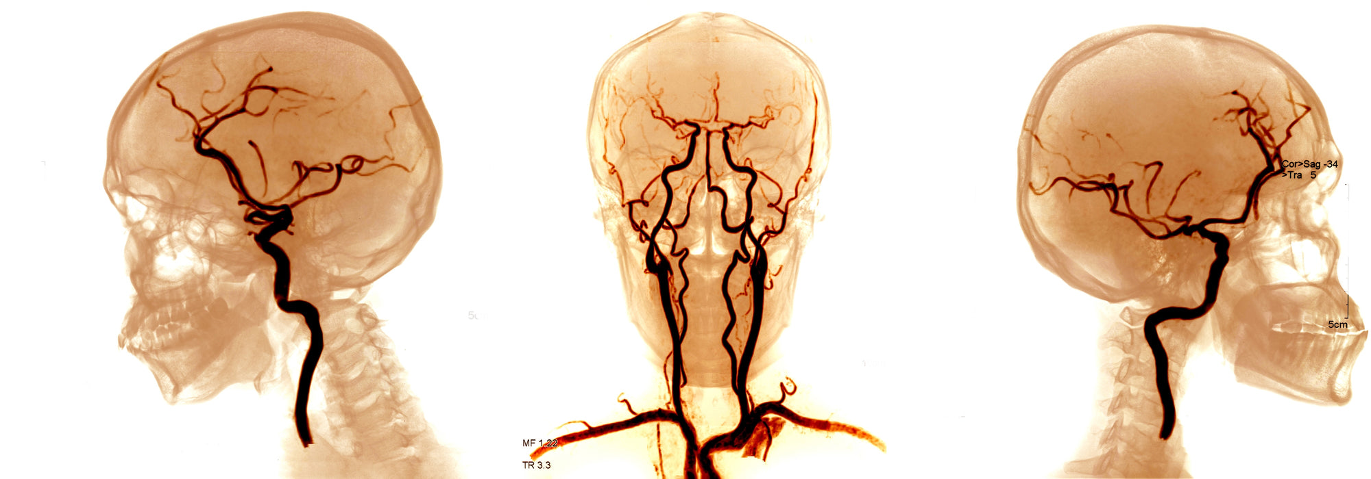 Neurology Made Ridiculously Simple