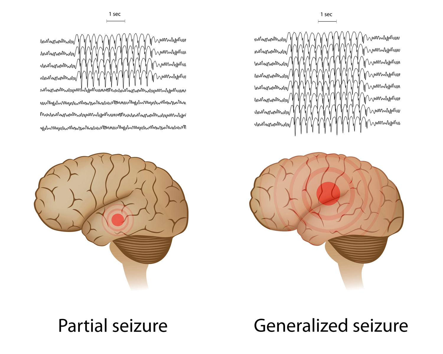 Neurology Made Ridiculously Simple