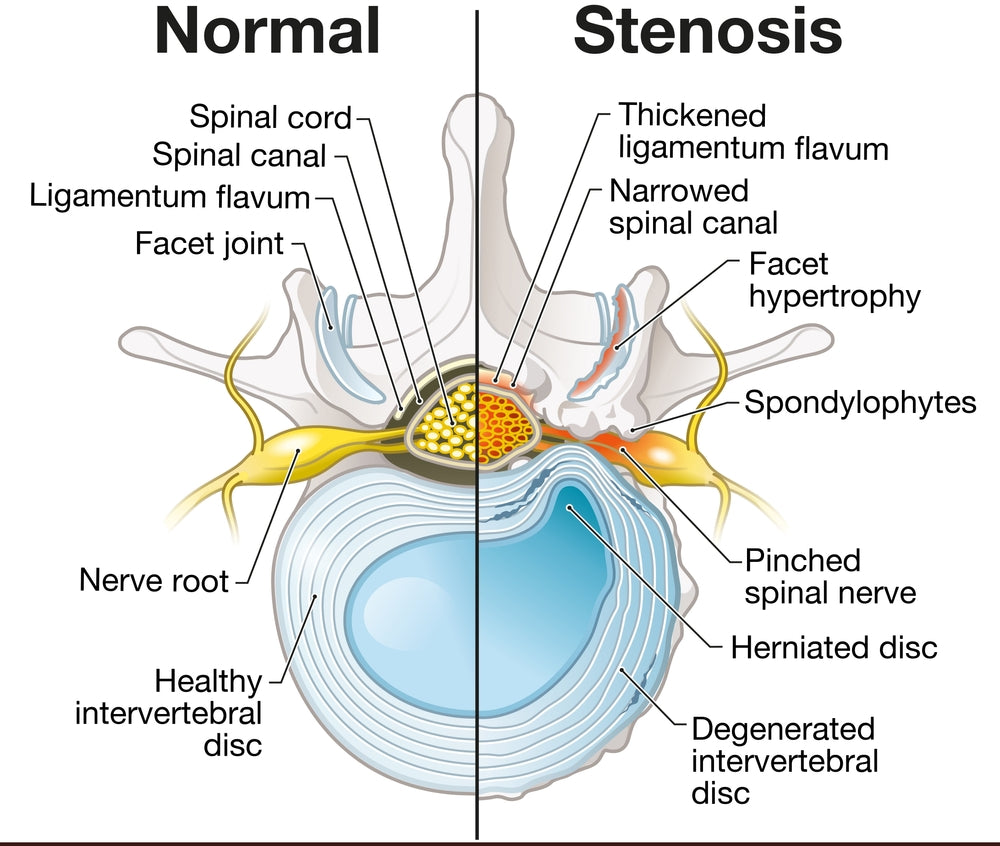 Neurology Made Ridiculously Simple