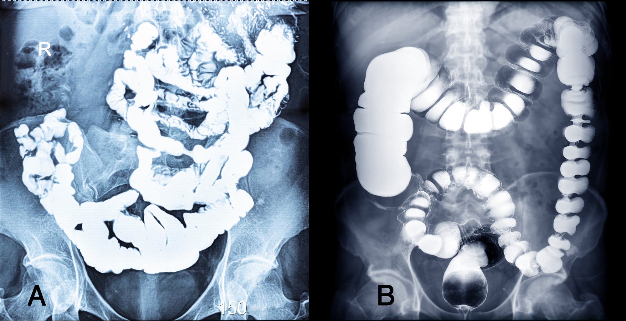 Gastroenterology Made Ridiculously Simple