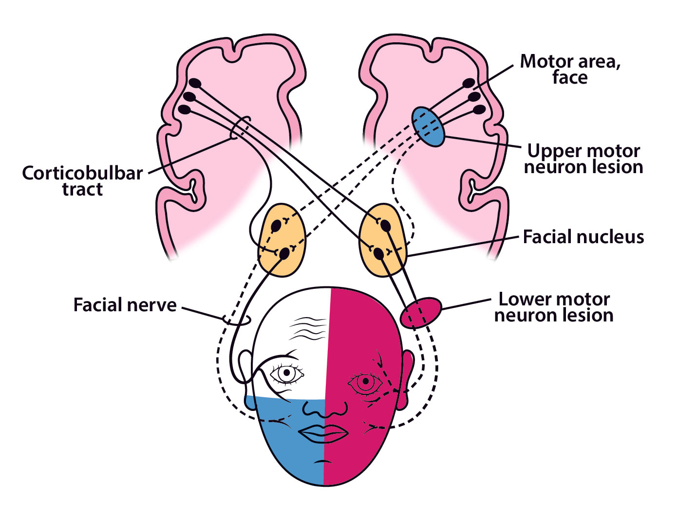 Neurology Made Ridiculously Simple