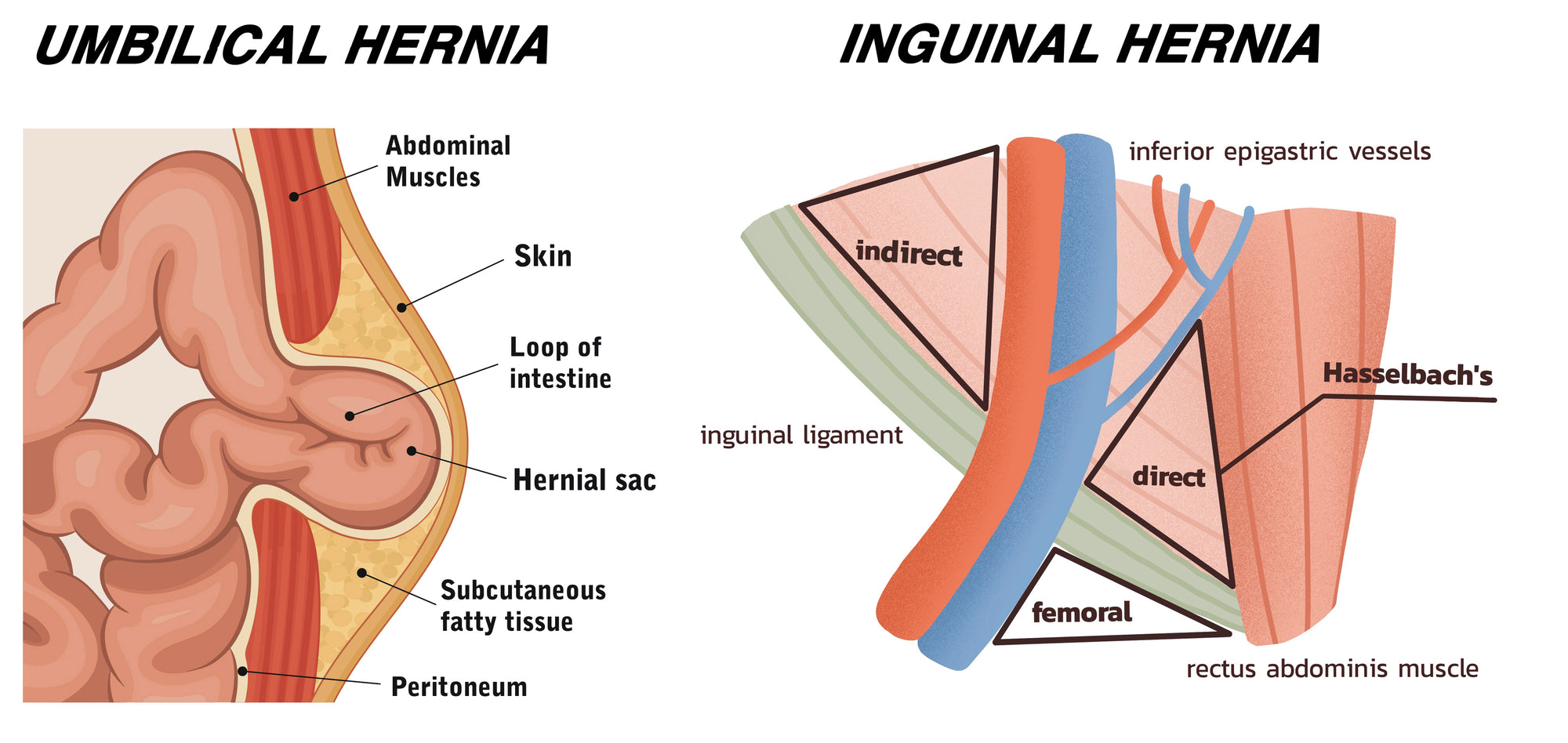Gastroenterology Made Ridiculously Simple