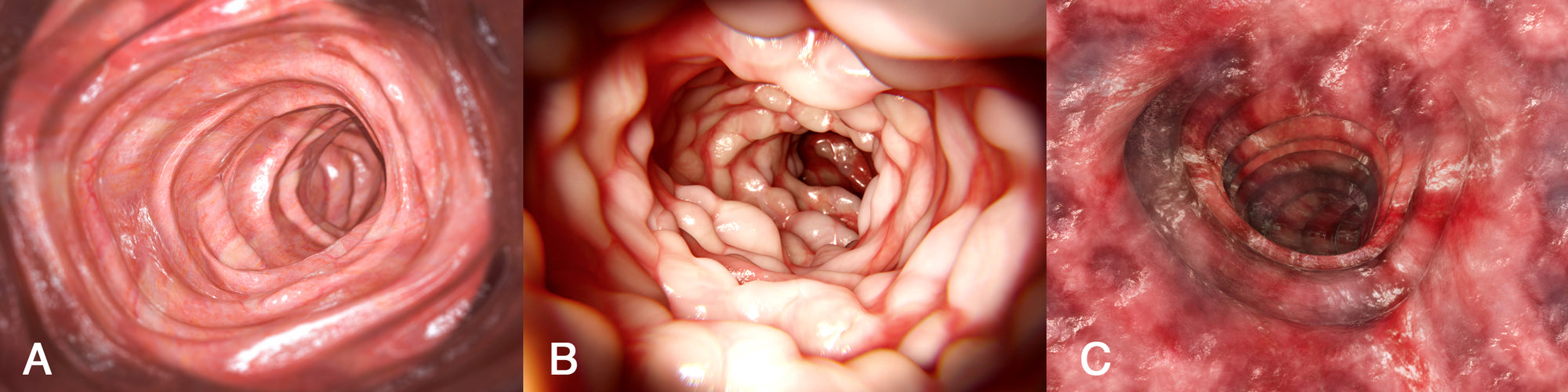 Gastroenterology Made Ridiculously Simple