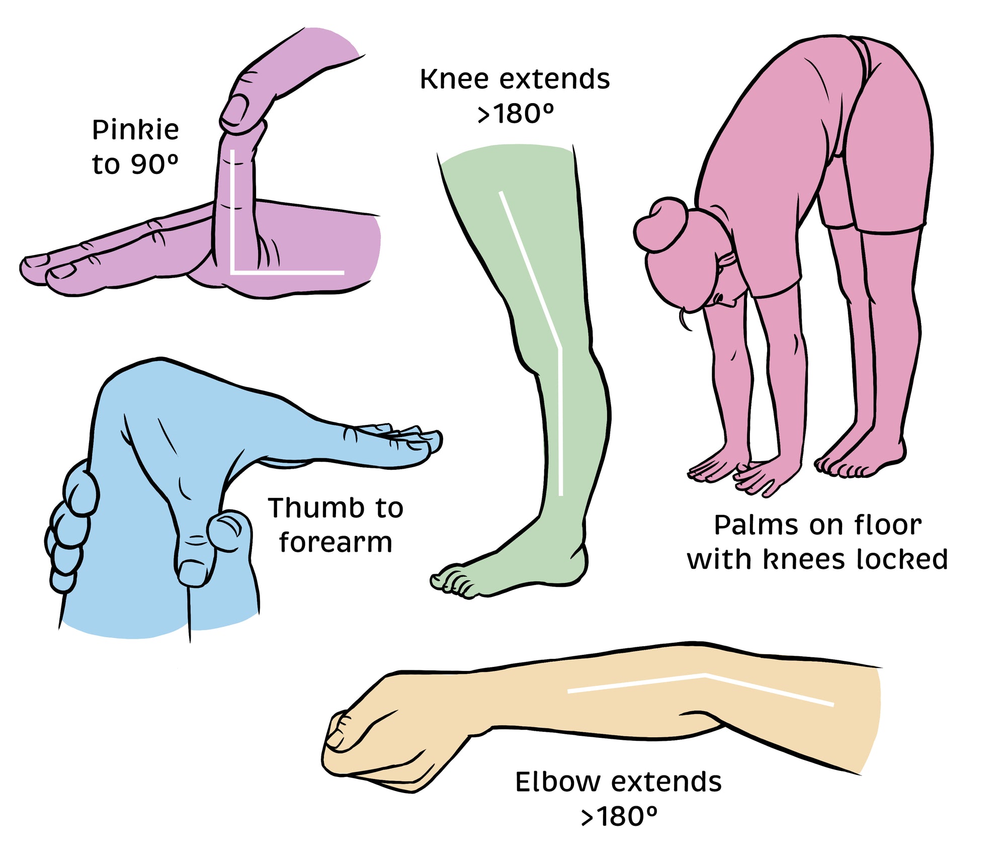 Rheumatology Made Ridiculously Simple